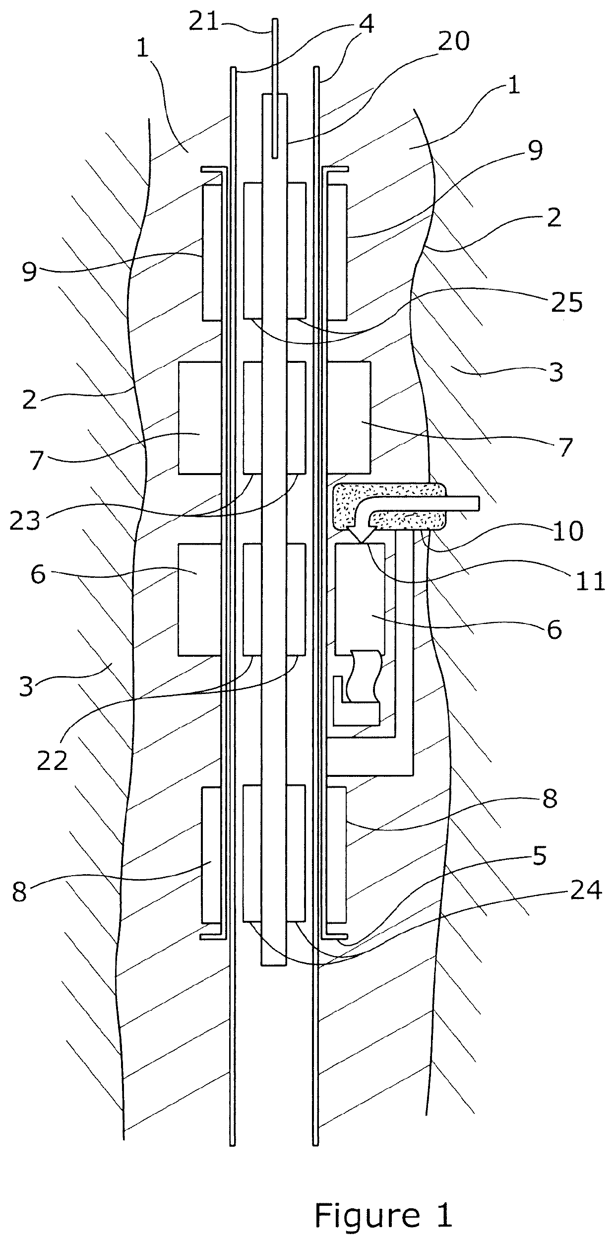 Sensor