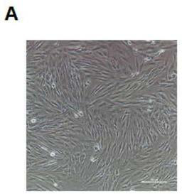 Method for establishing disease model of 'human-derived' short QT syndrome