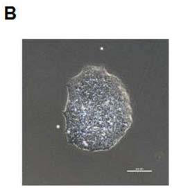 Method for establishing disease model of 'human-derived' short QT syndrome