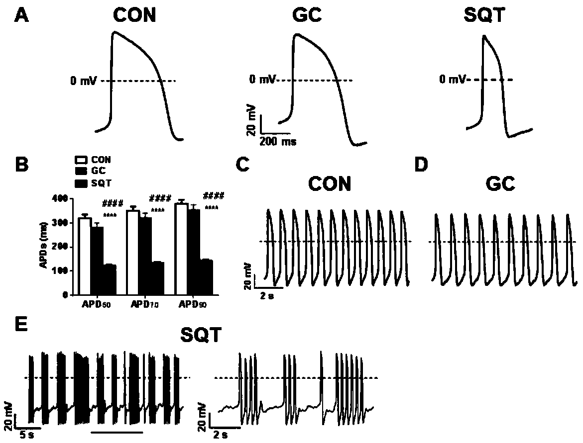 Method for establishing disease model of 'human-derived' short QT syndrome