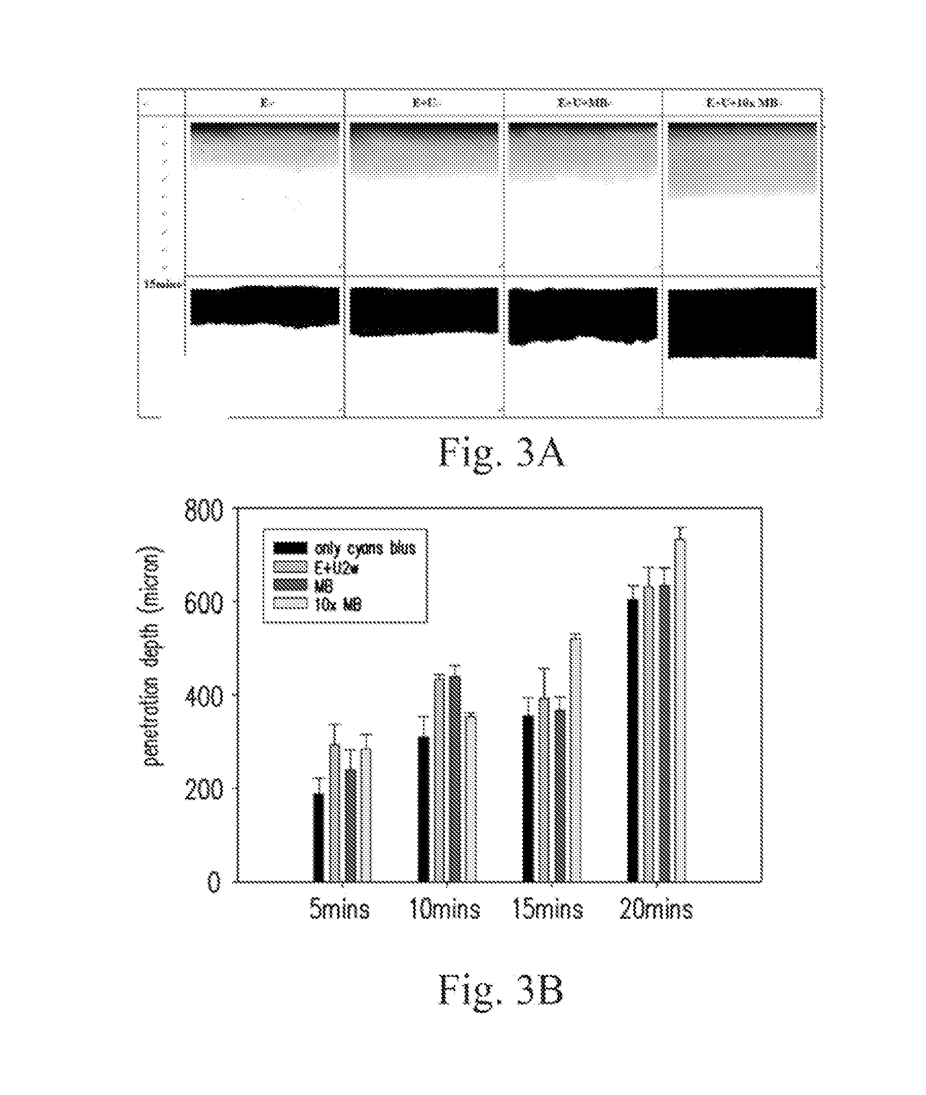 Microbubble ultrasound contrast agent for external use