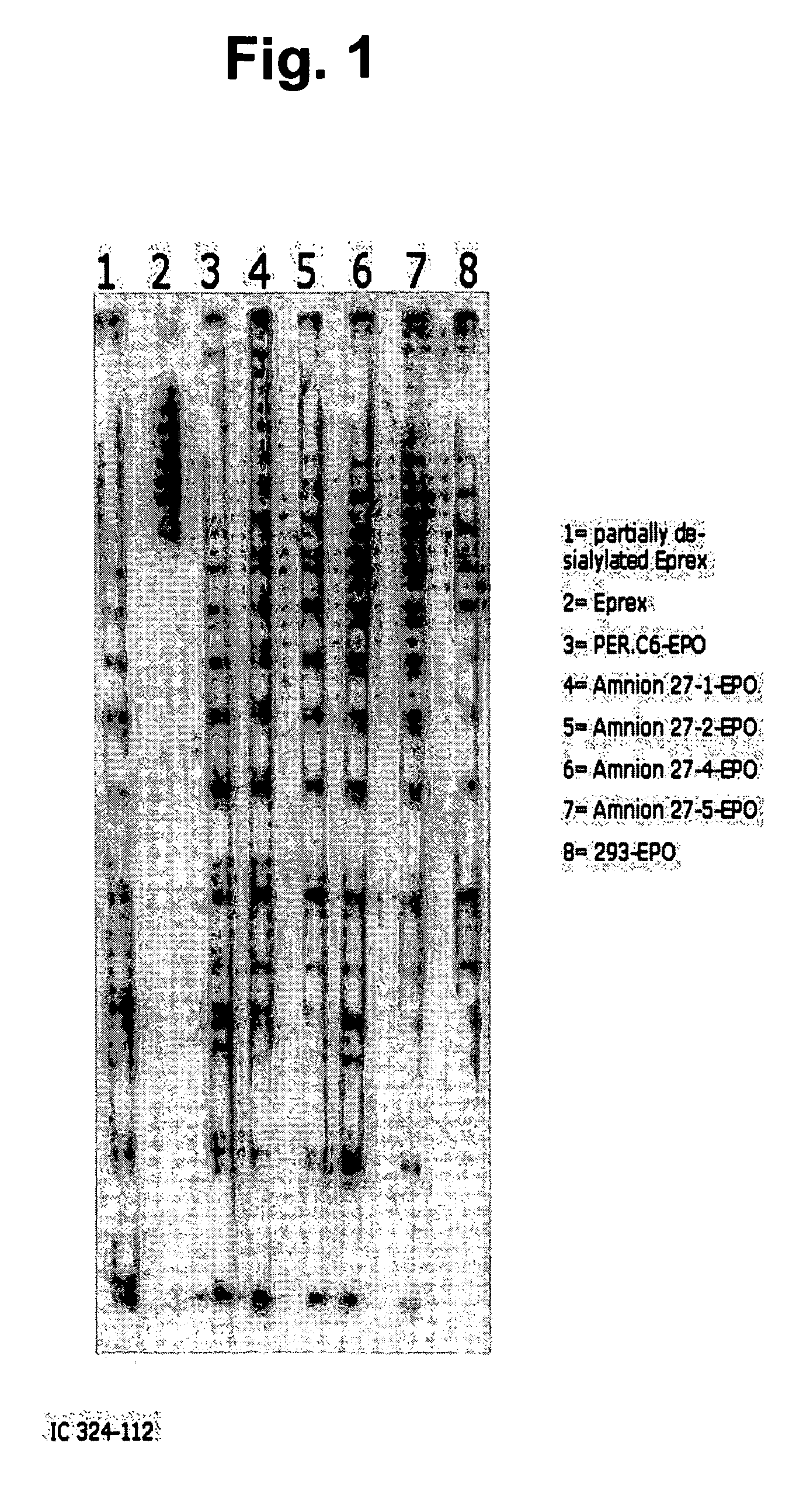 Recombinant protein production in permanent amniocytic cells that comprise nucleic acid encoding adenovirus E1A and E1B proteins