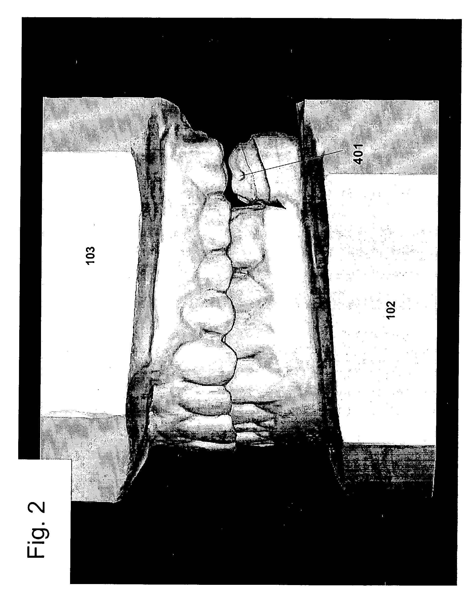 Method and apparatus for constructing crowns, bridges and implants for dental use