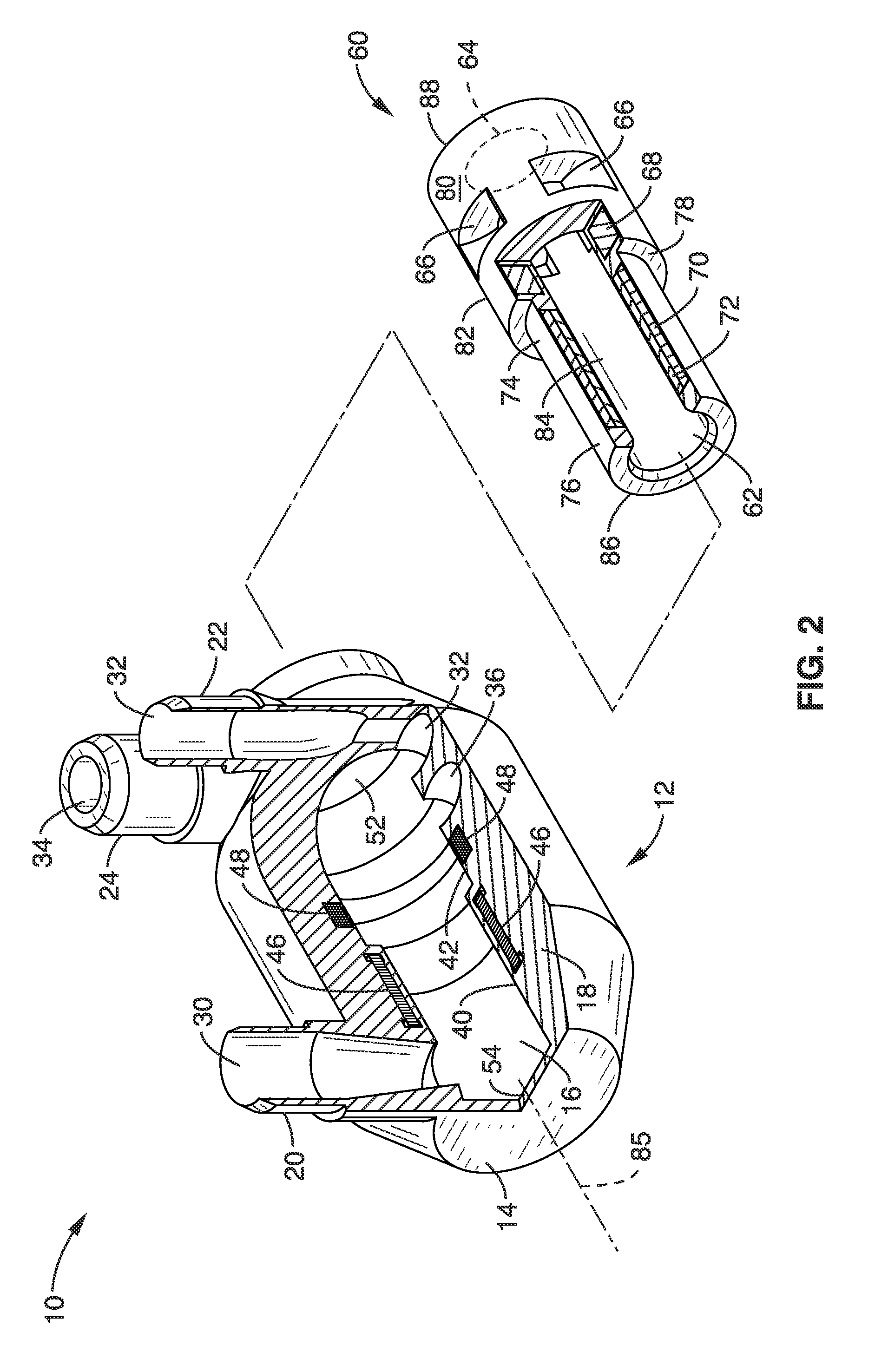 Total artificial heart