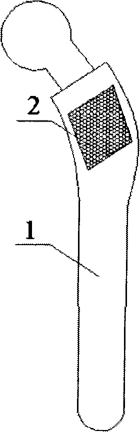 Preparation of artificial joint prosthesis with partially controllable porous structure