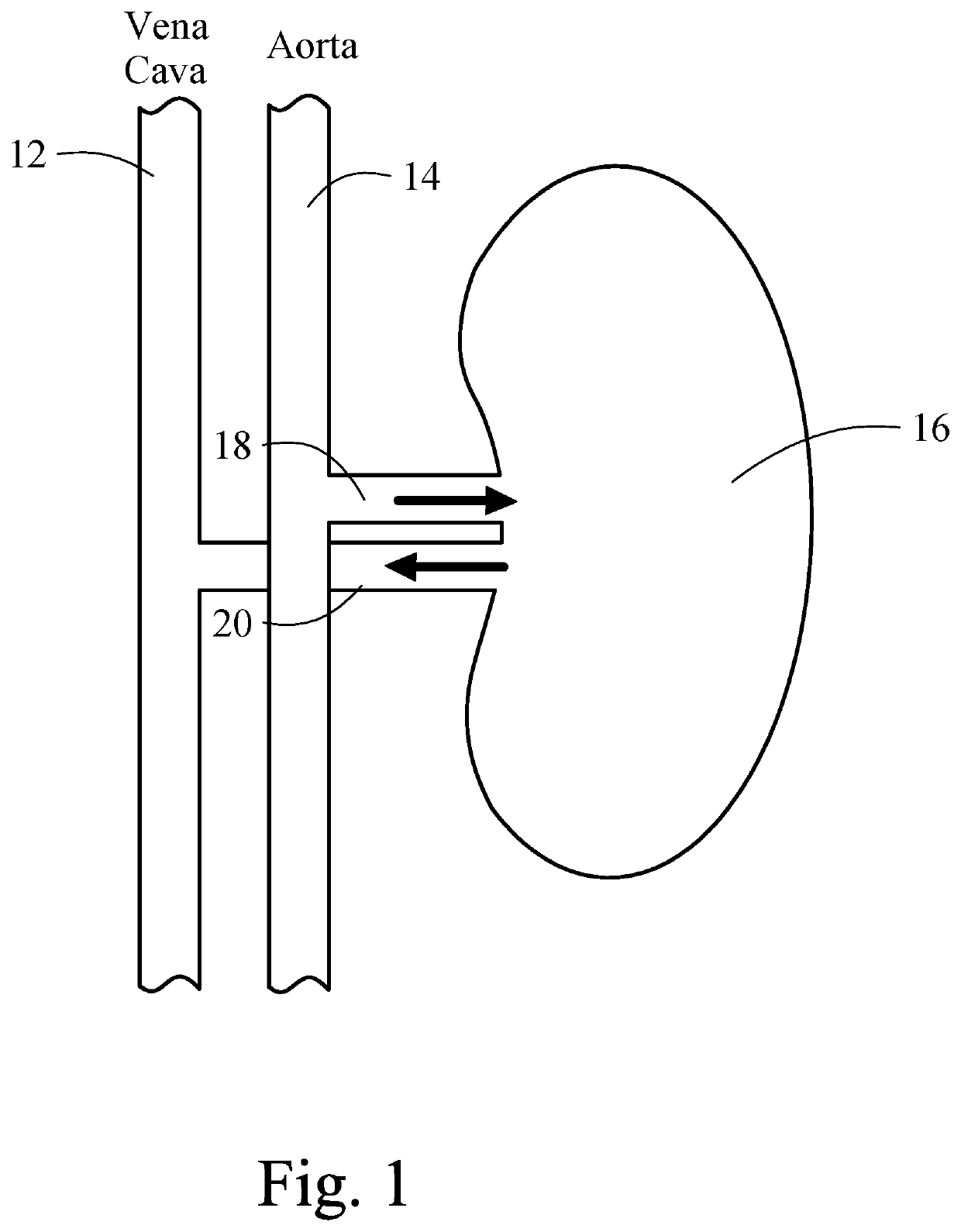 Method for preventing contrast induced nephropathy