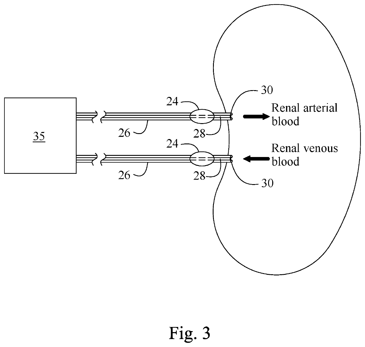 Method for preventing contrast induced nephropathy