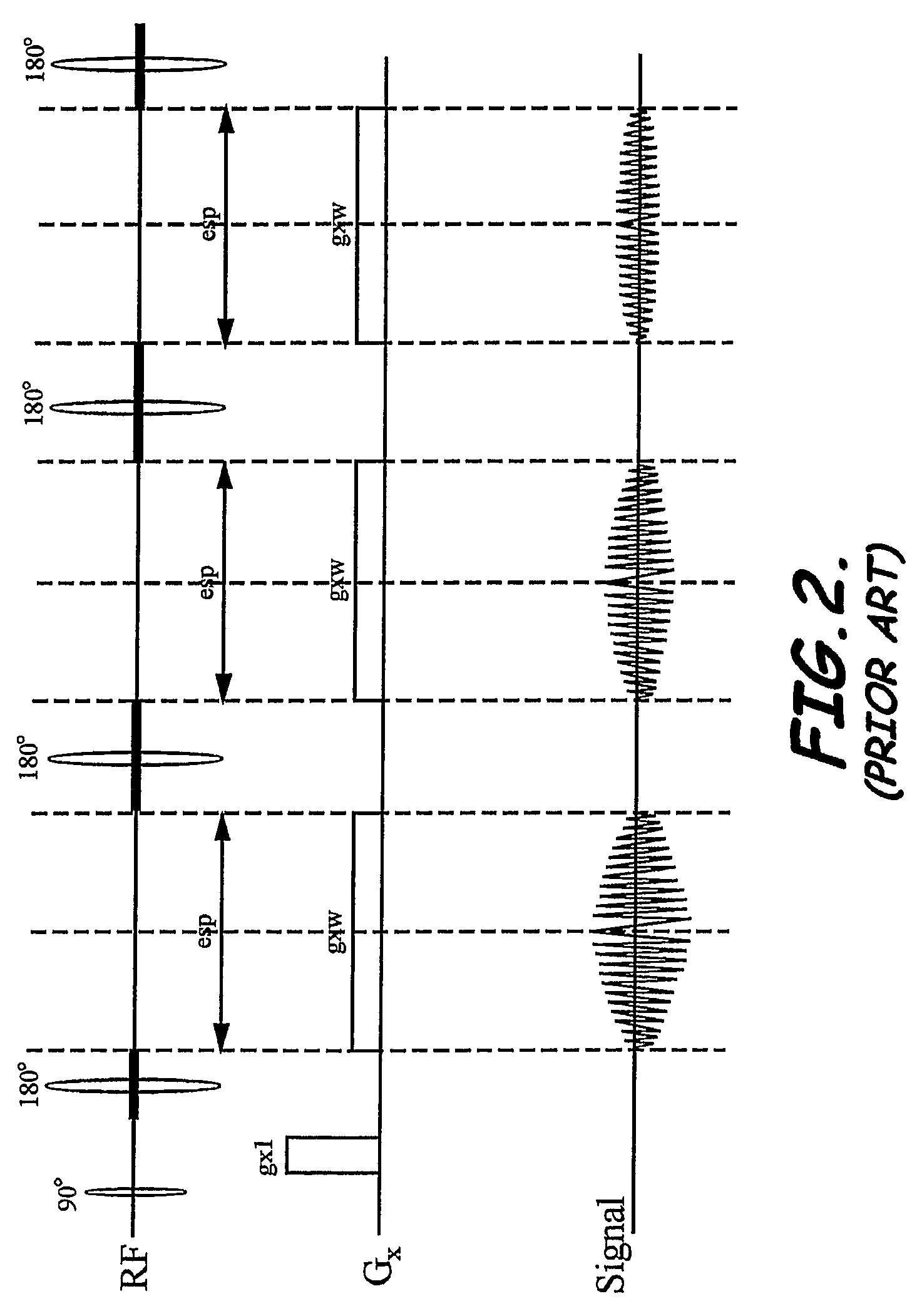 System, program product, and method of acquiring and processing MRI data for simultaneous determination of water, fat, and transverse relaxation time constants