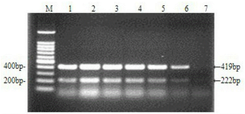 H9 Subtype Avian Influenza Virus and Duck Tembusu Virus Duplex RT-PCR Detection Kit