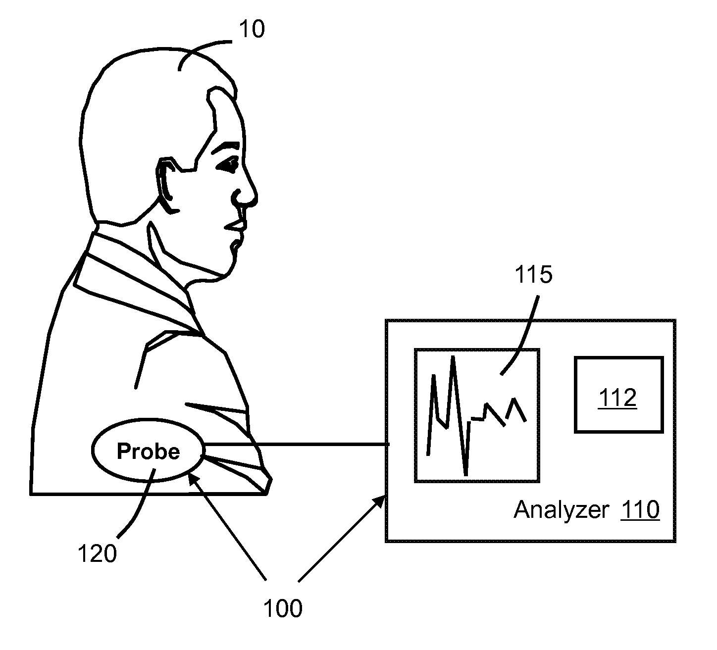 System and method for predicting successful defibrillation for ventricular fibrillation cardiac arrest