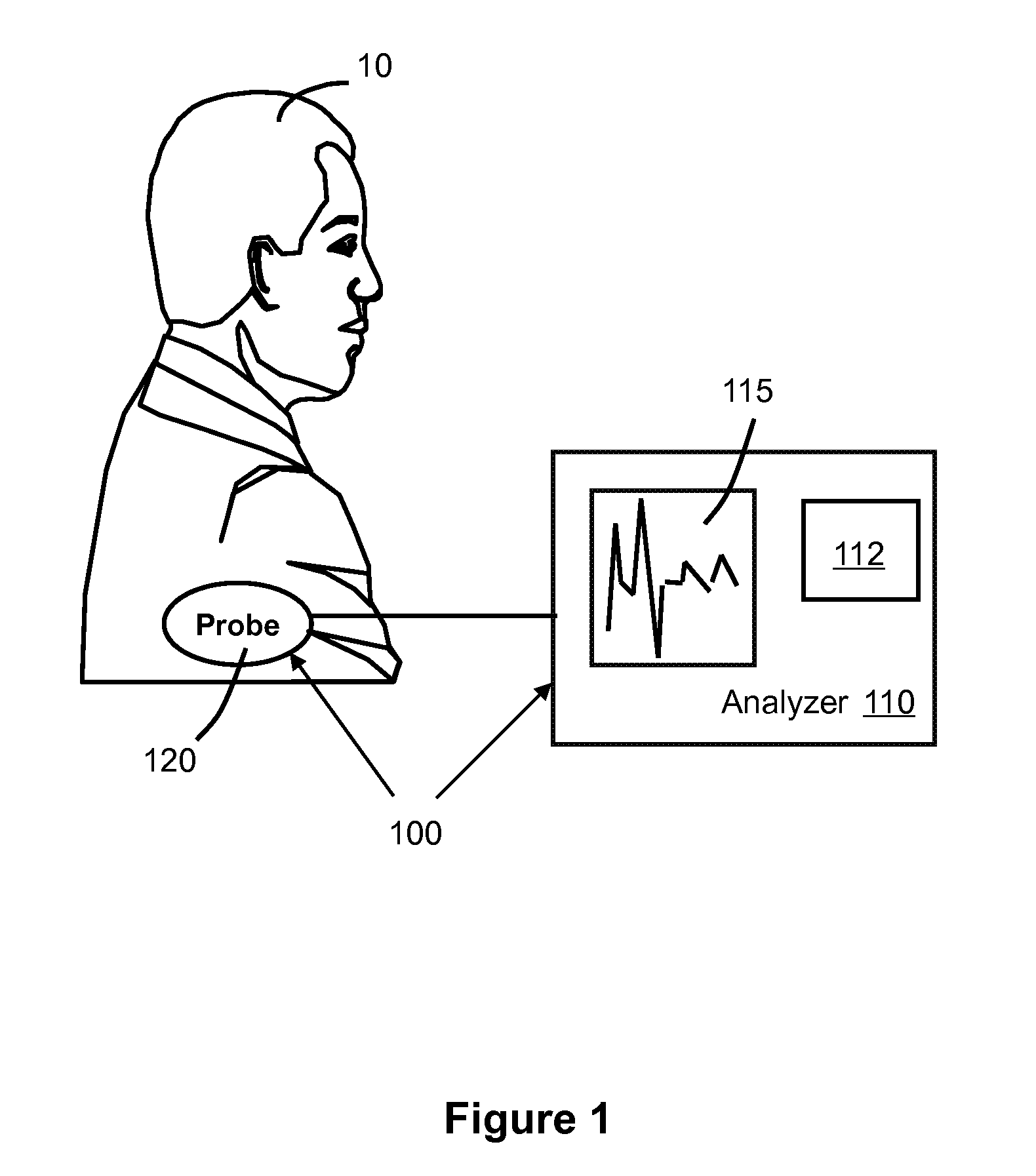 System and method for predicting successful defibrillation for ventricular fibrillation cardiac arrest