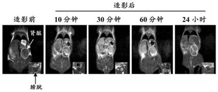 Manganese (III) porphyrin pentamer contrast agent applied to magnetic resonance imaging and application thereof