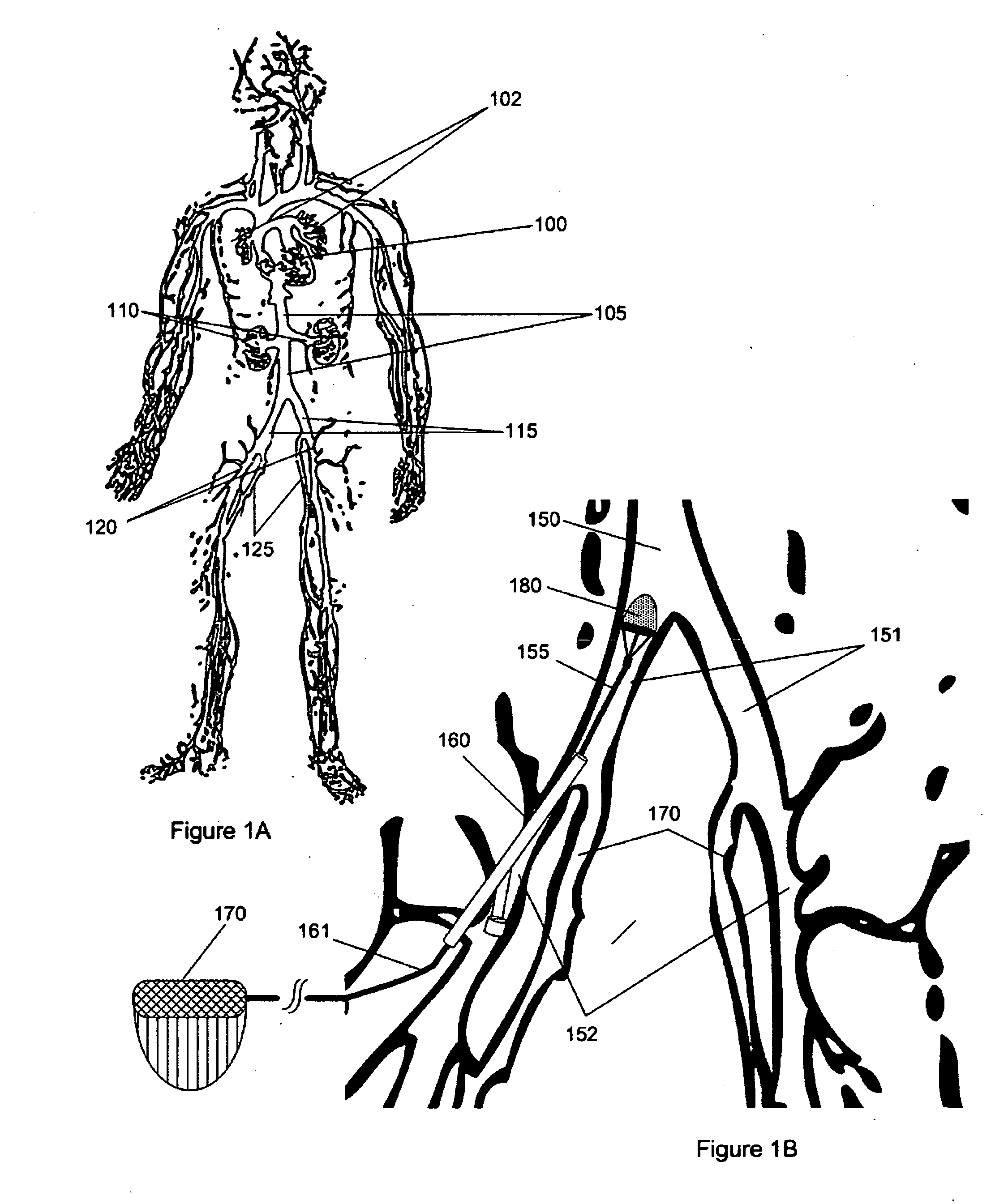 Electrostatic vascular filters