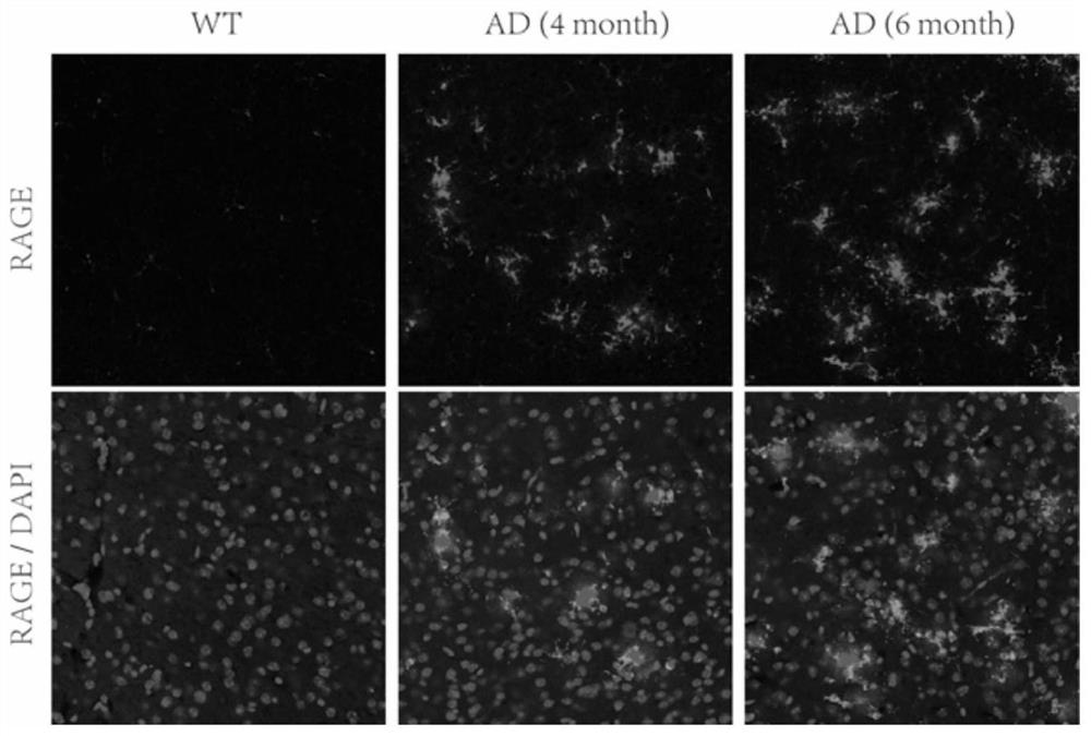 Nanobody targeting rage and its application