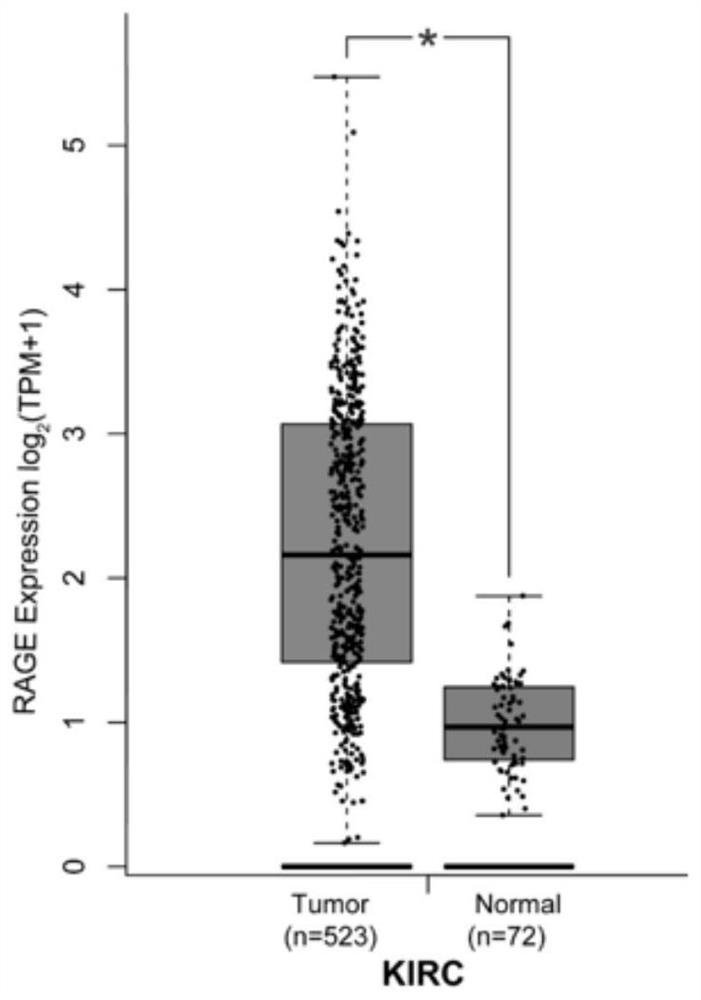 Nanobody targeting rage and its application