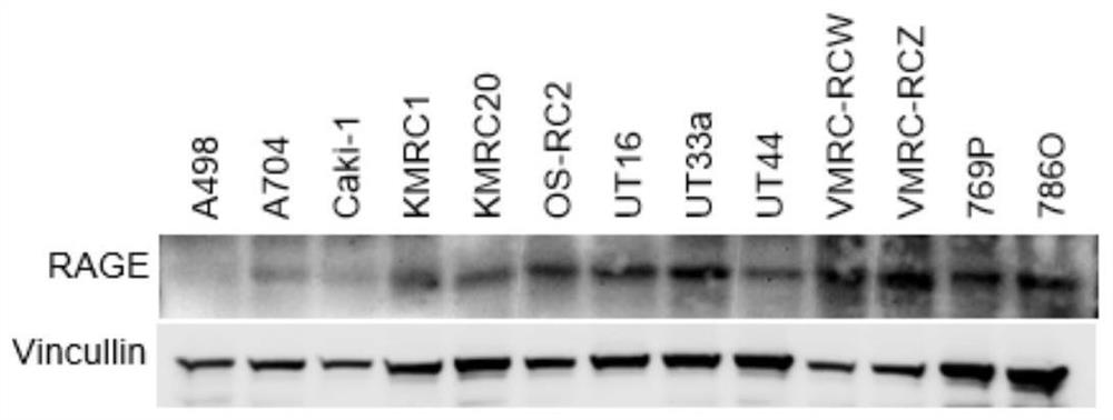 Nanobody targeting rage and its application