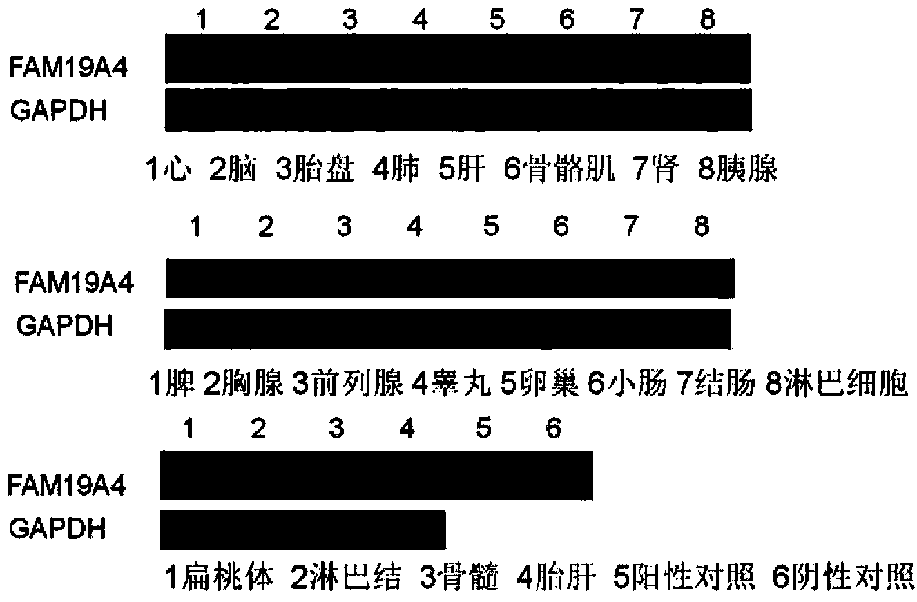 Cell factor FAM19A4 with anti-infection and antineoplastic activity and application thereof