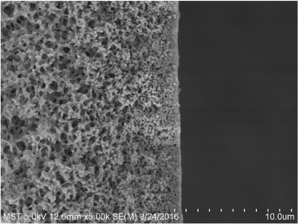 High-pollution-resistance type polyvinylidene fluoride (PVDF) hollow fiber ultrafiltration membrane, preparation method and device