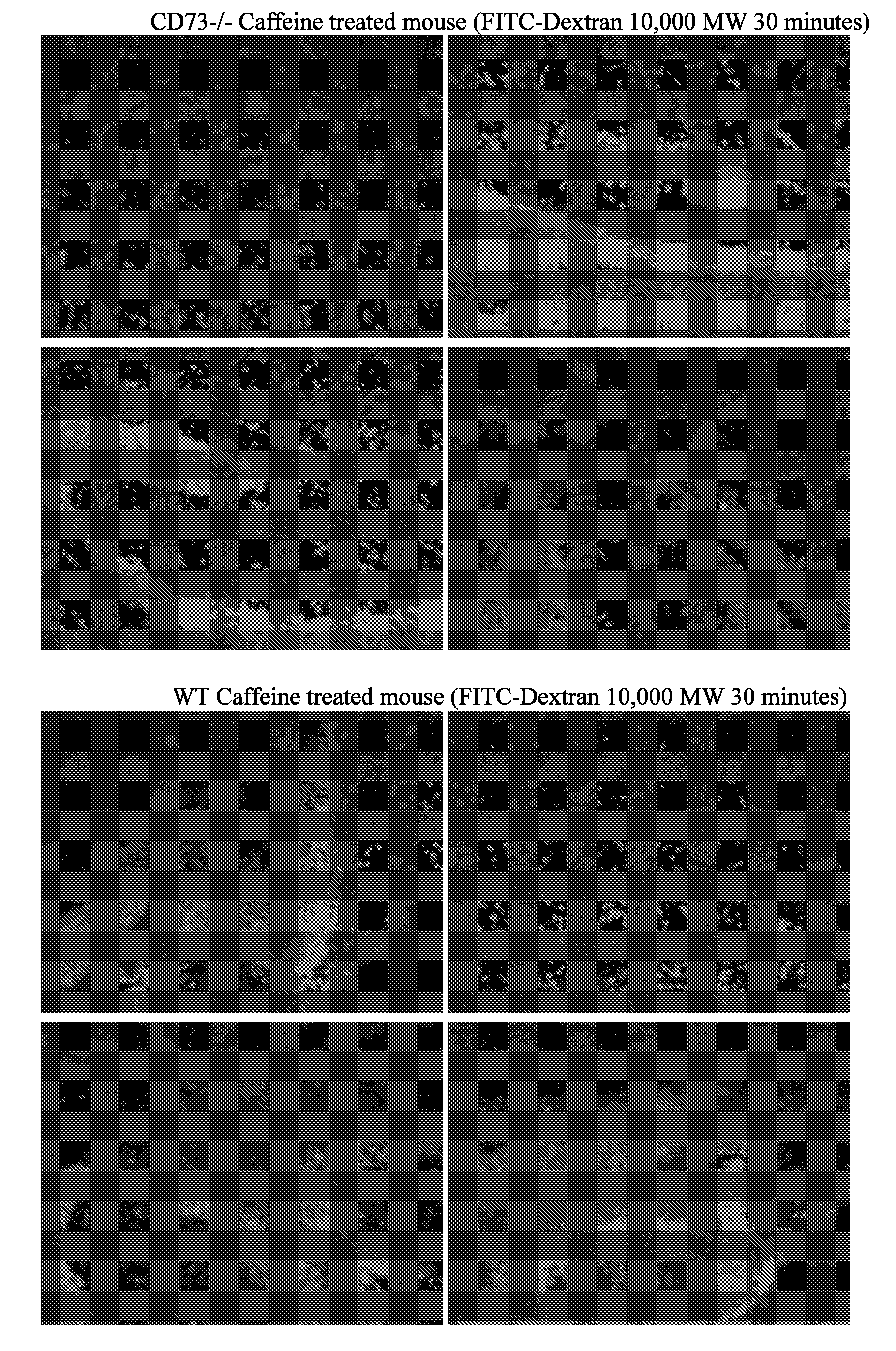 Modulation of blood brain barrier permeability