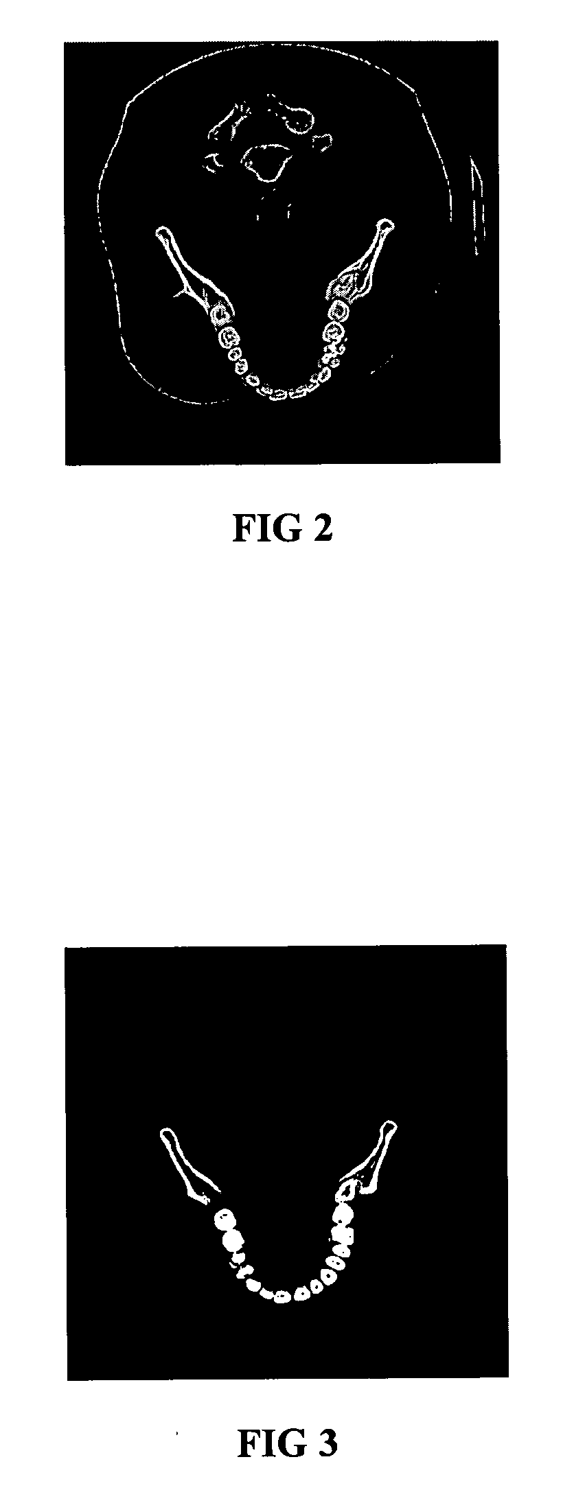 Method for designing 3-dimensional porous tissue engineering scaffold