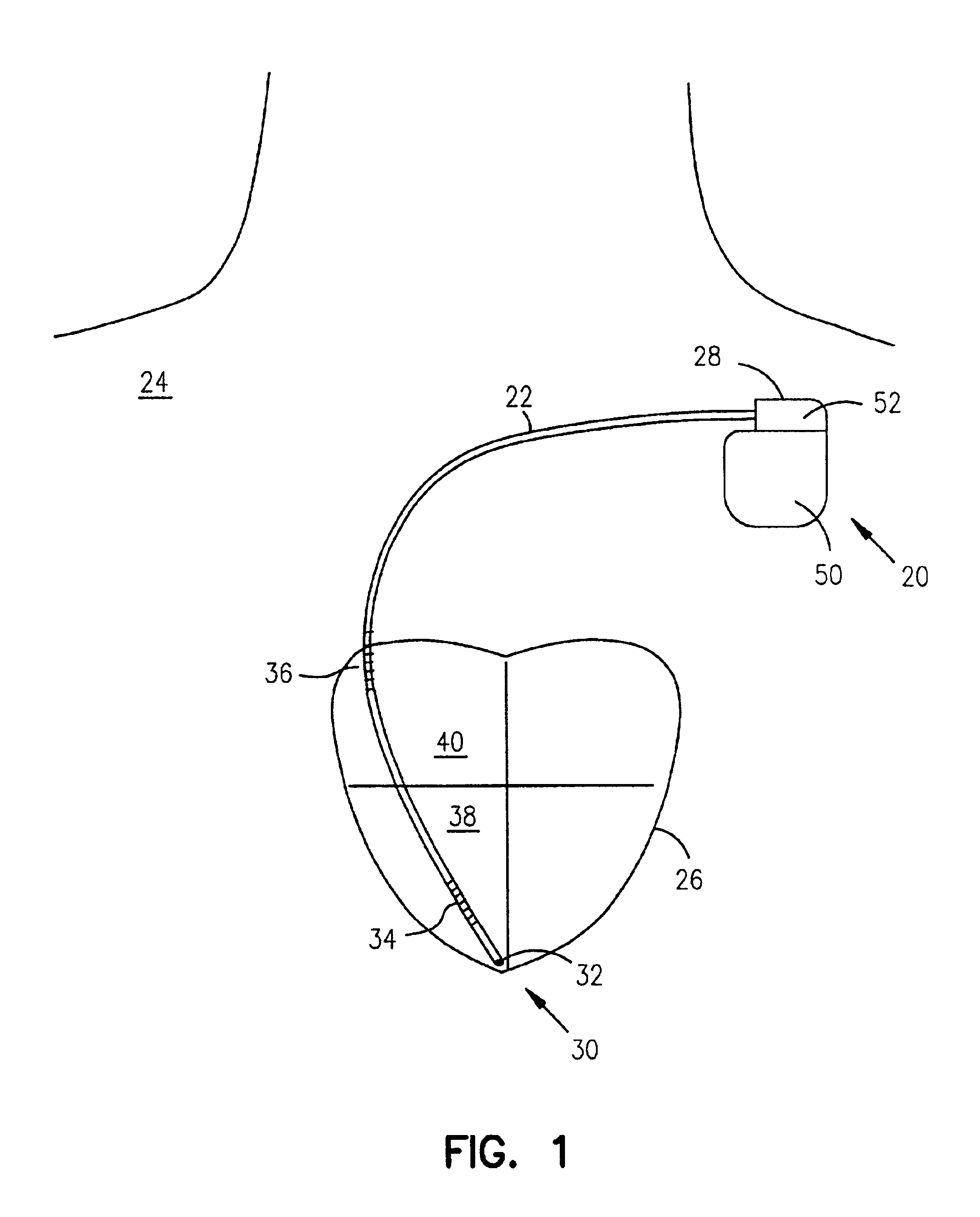 Method and system for identifying and displaying groups of cardiac arrhythmic episodes