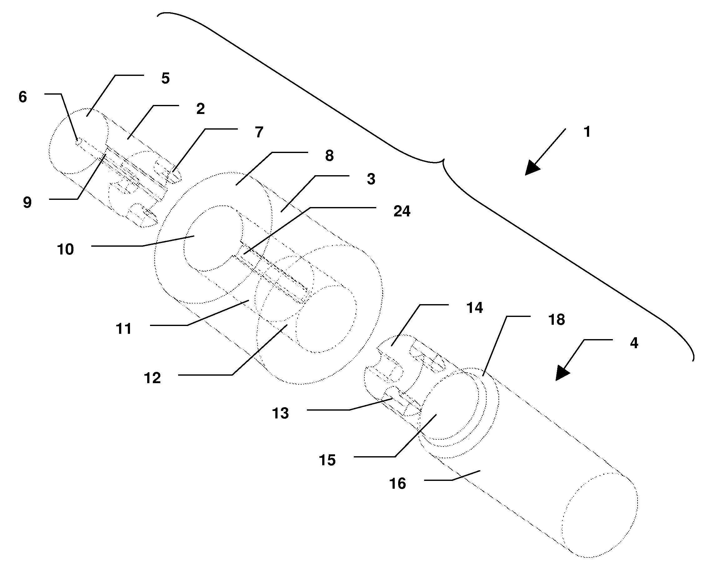 Dental Implant System and Method