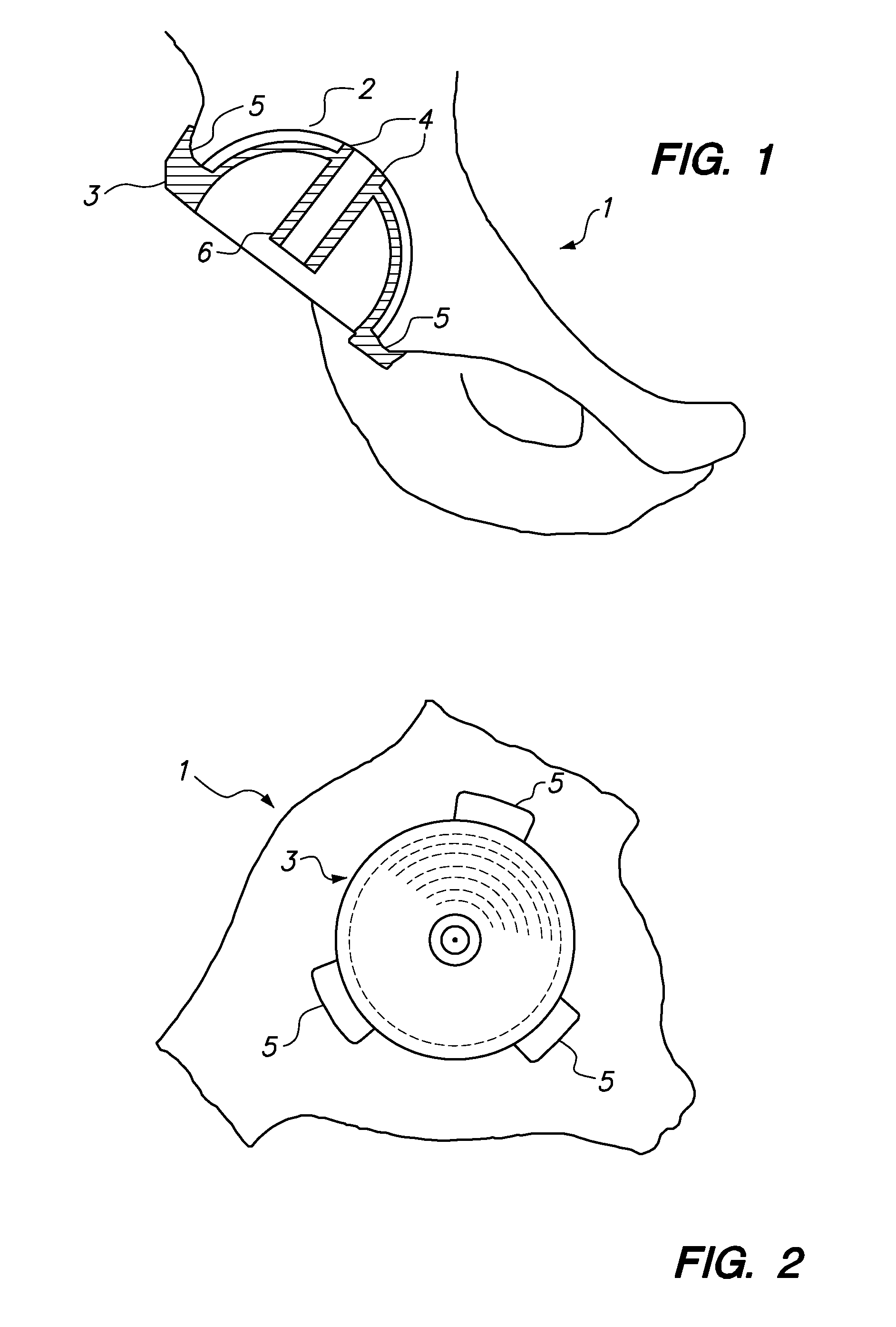 Device and method for achieving accurate positioning of acetabular cup during total hip replacement