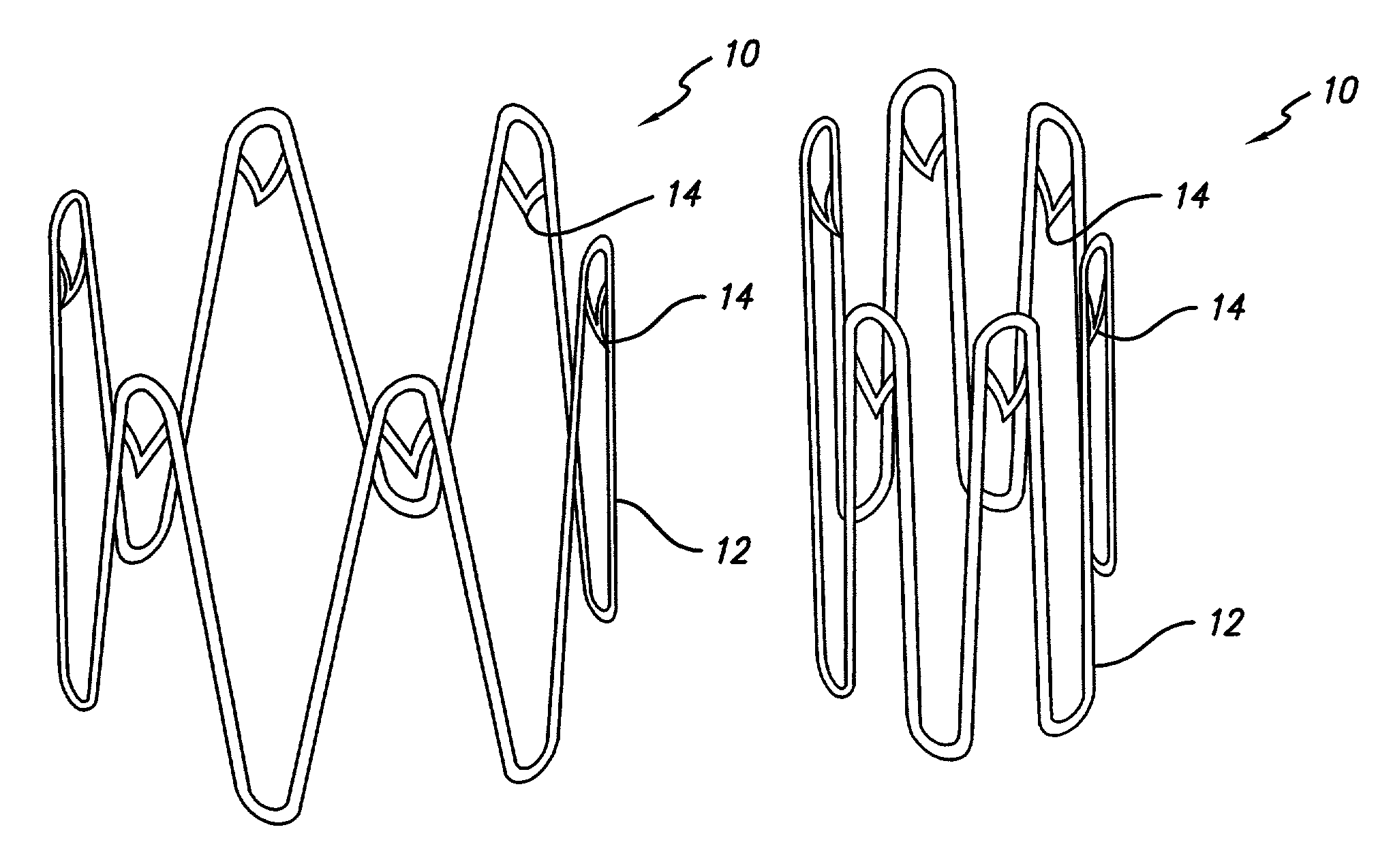 Anchoring device for an endoluminal prosthesis