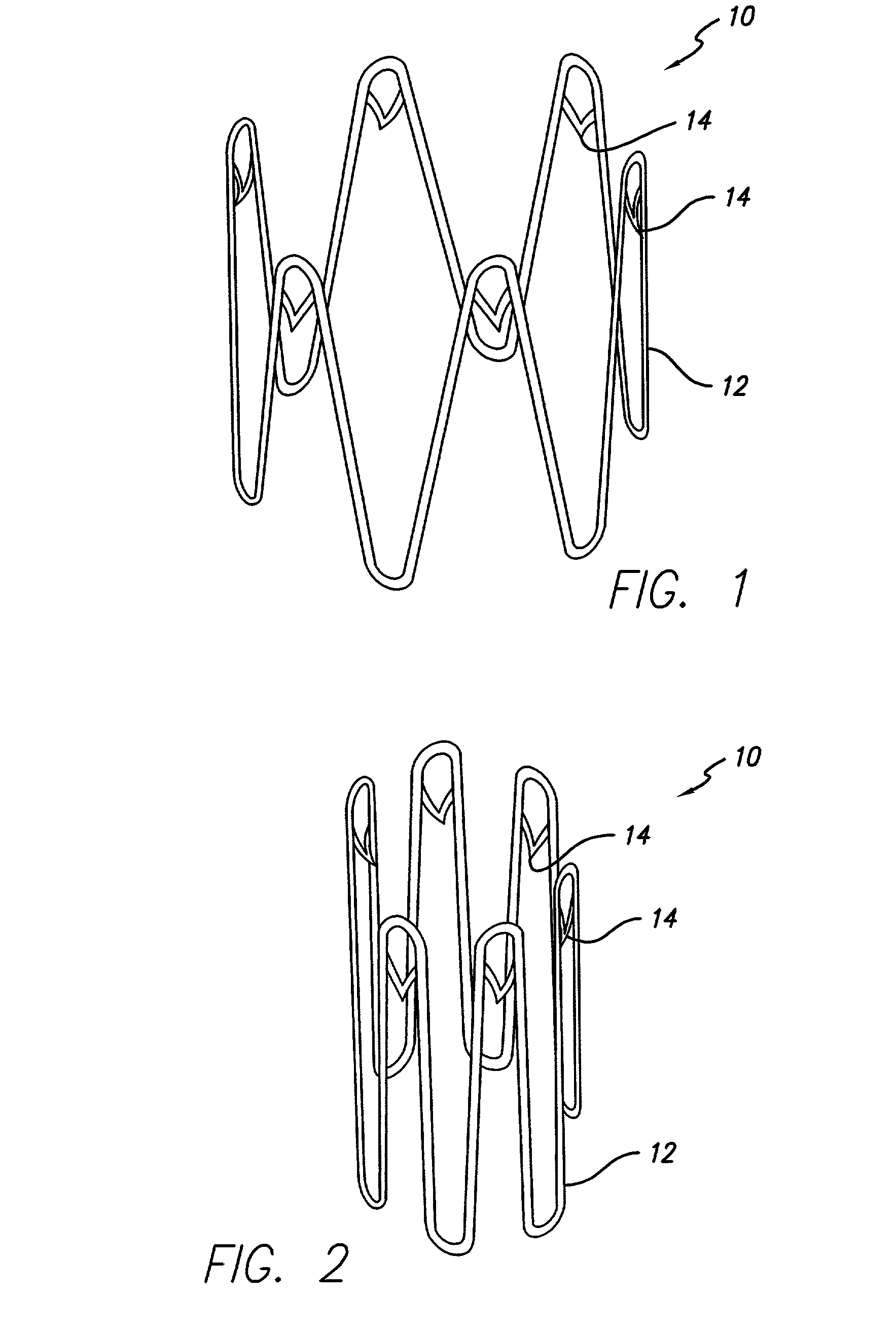 Anchoring device for an endoluminal prosthesis