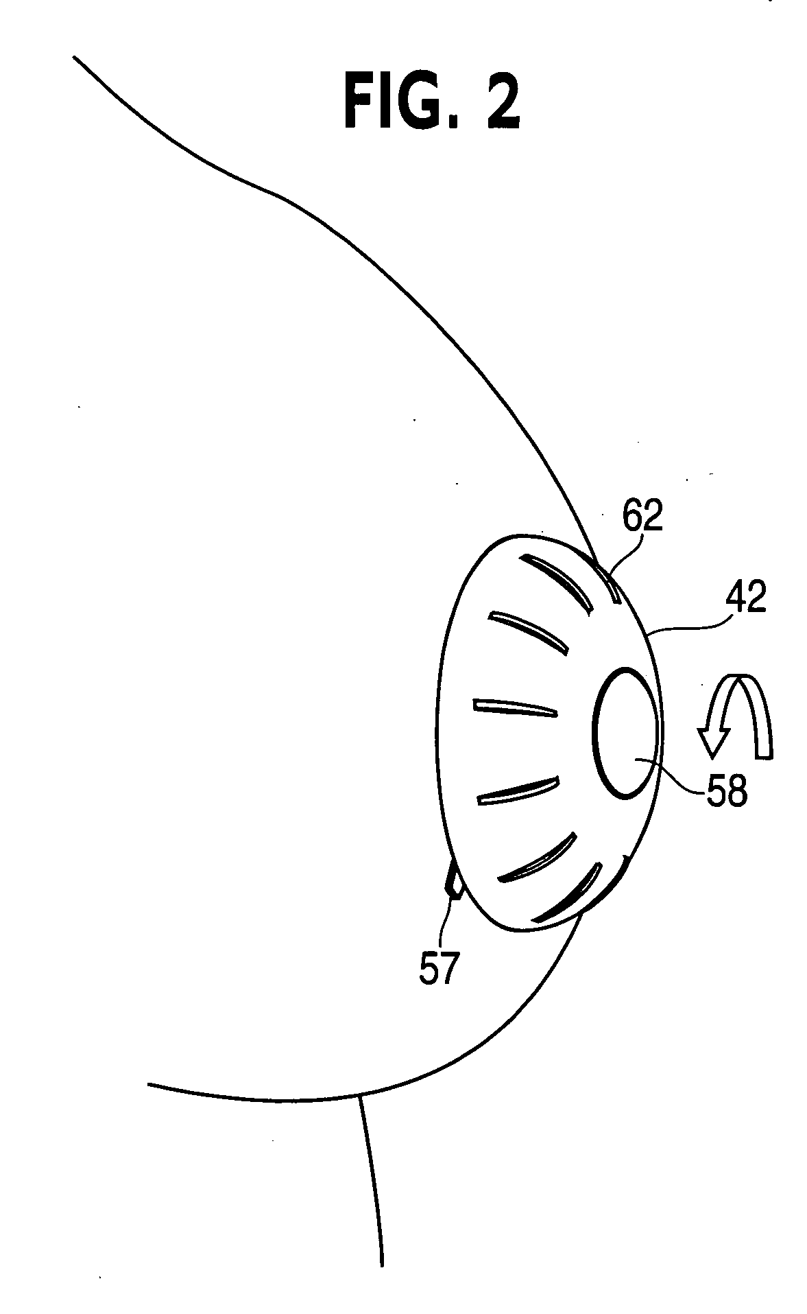 Device for non-surgical correction of congenital inverted nipples and/or collection of nipple aspirate fluid