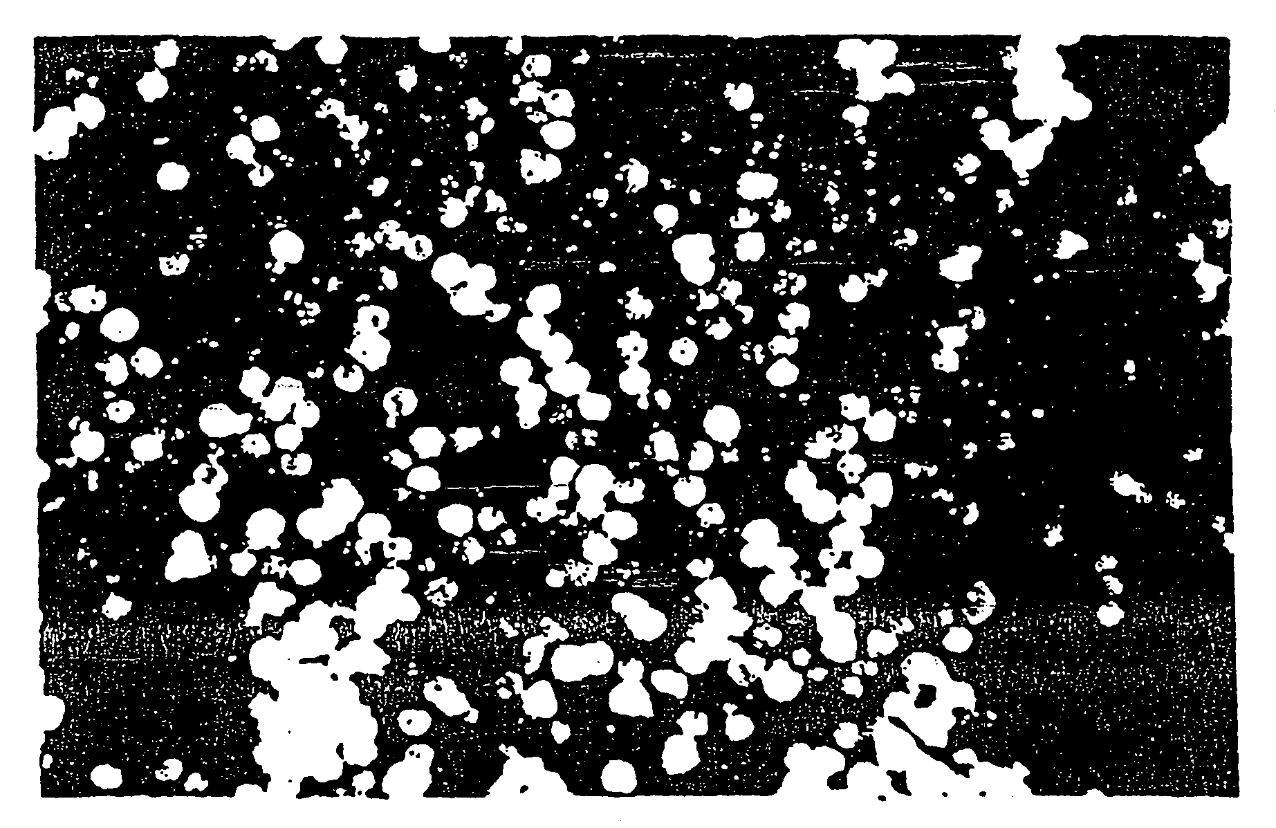 Tissue augmentation material and method