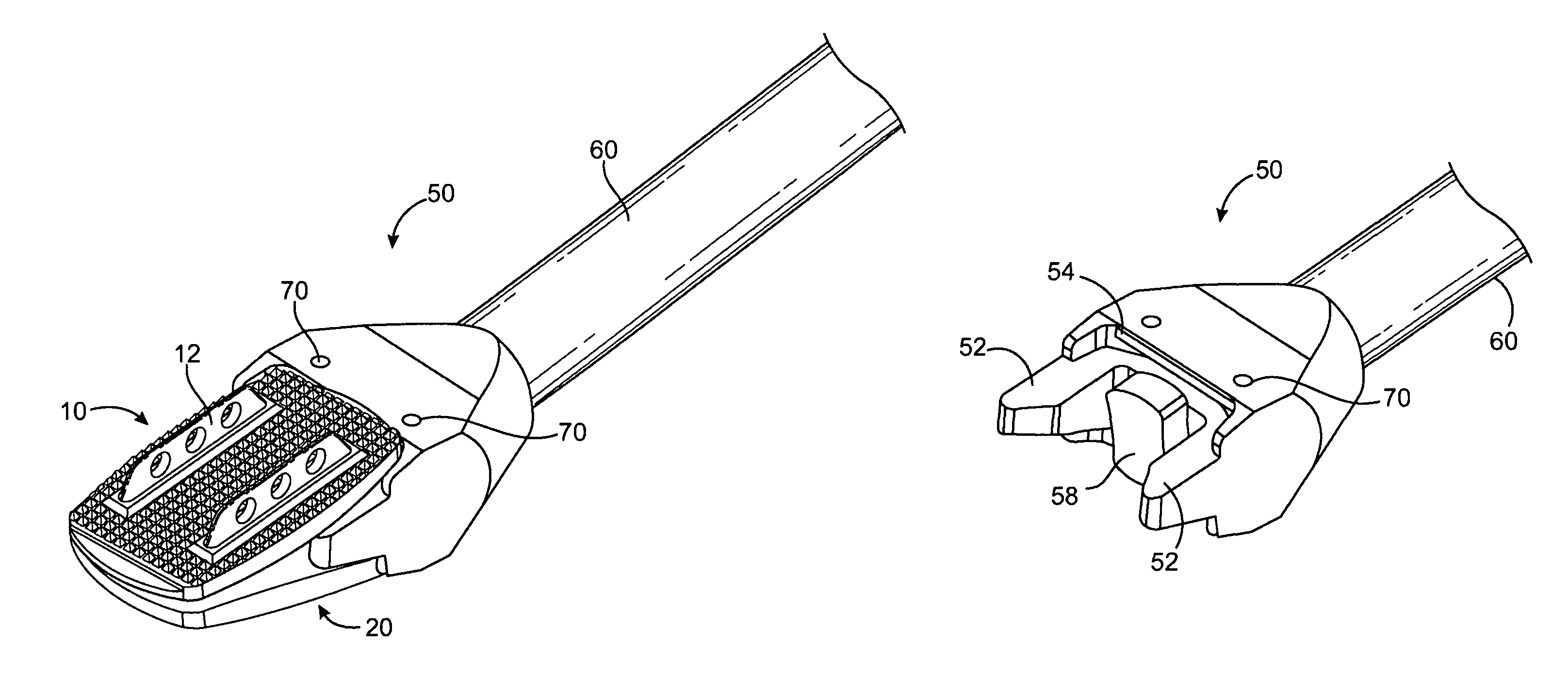 Artificial intervertebral disc placement system