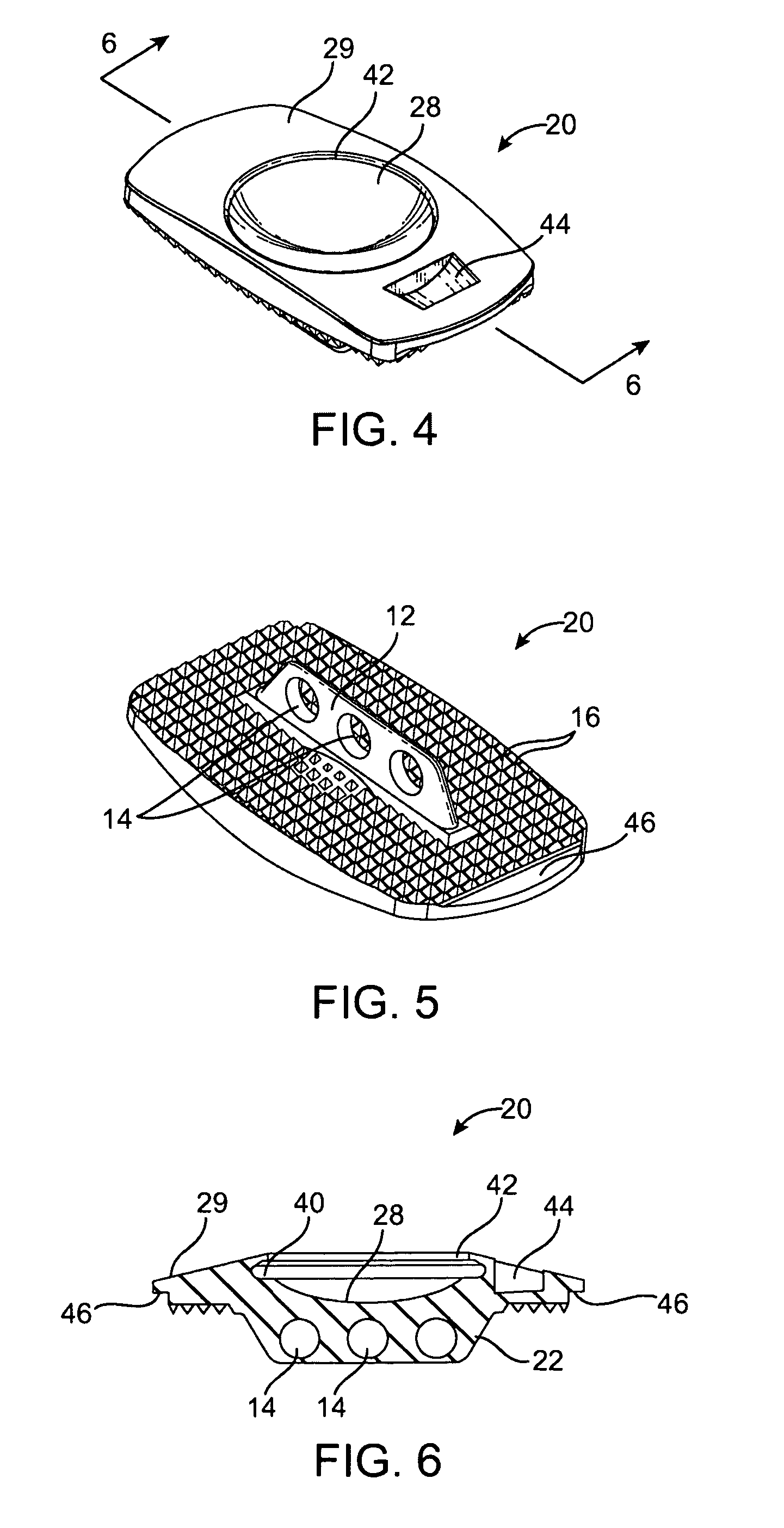 Artificial intervertebral disc placement system