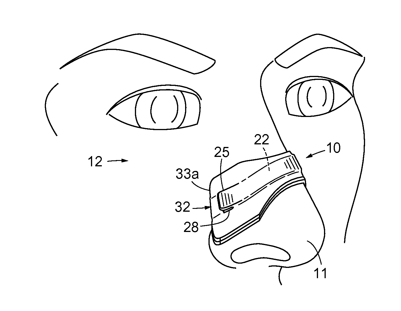 Nasal Dilator with Means to Direct Resilient Properties