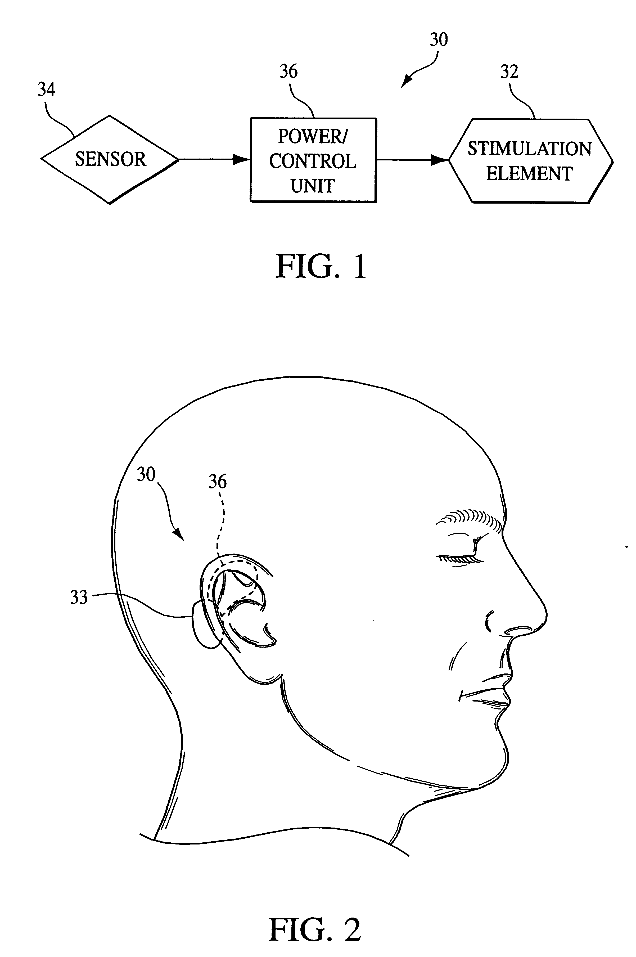 Vestibular stimulation system and method