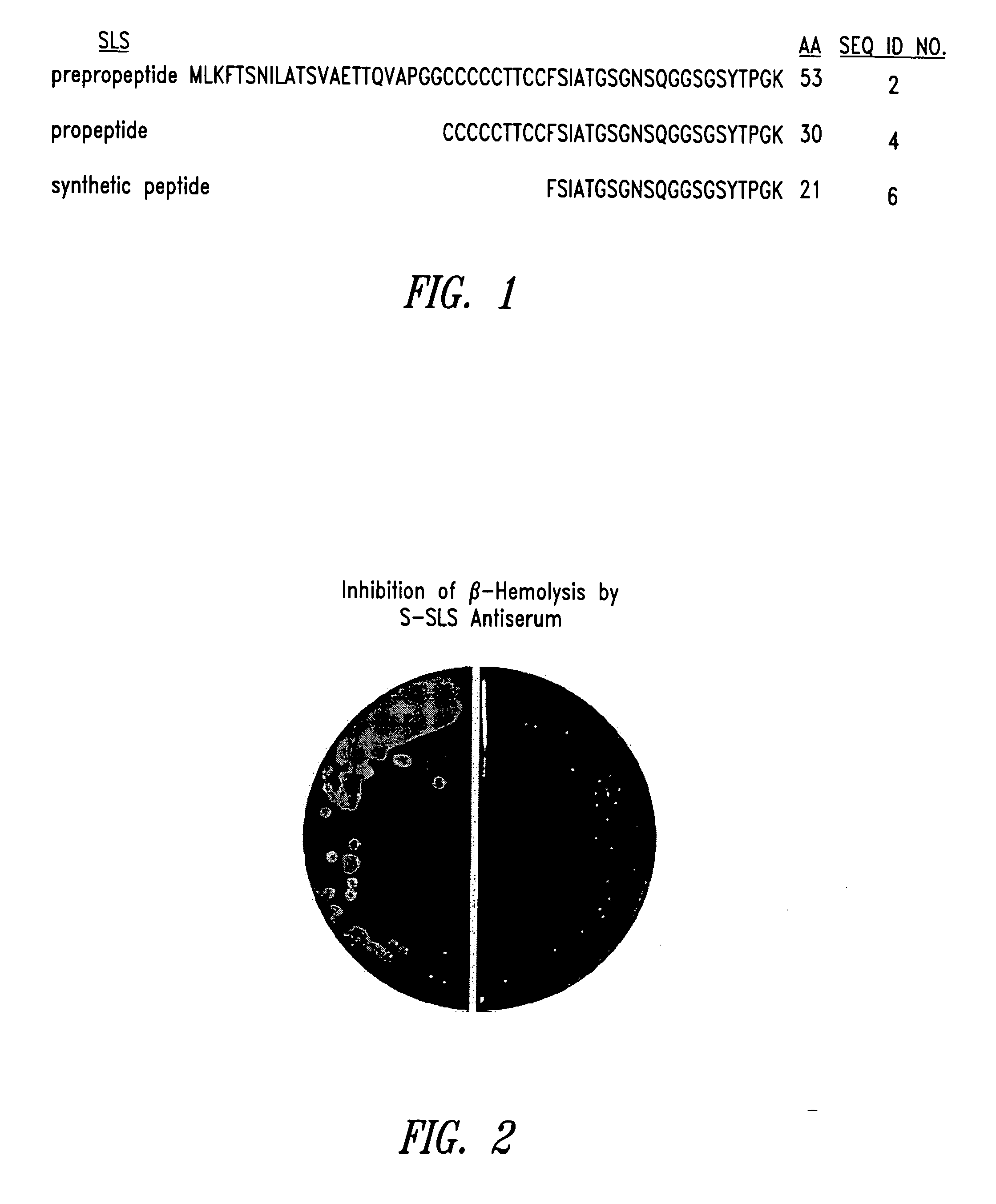 Streptococcal streptolysin S vaccines