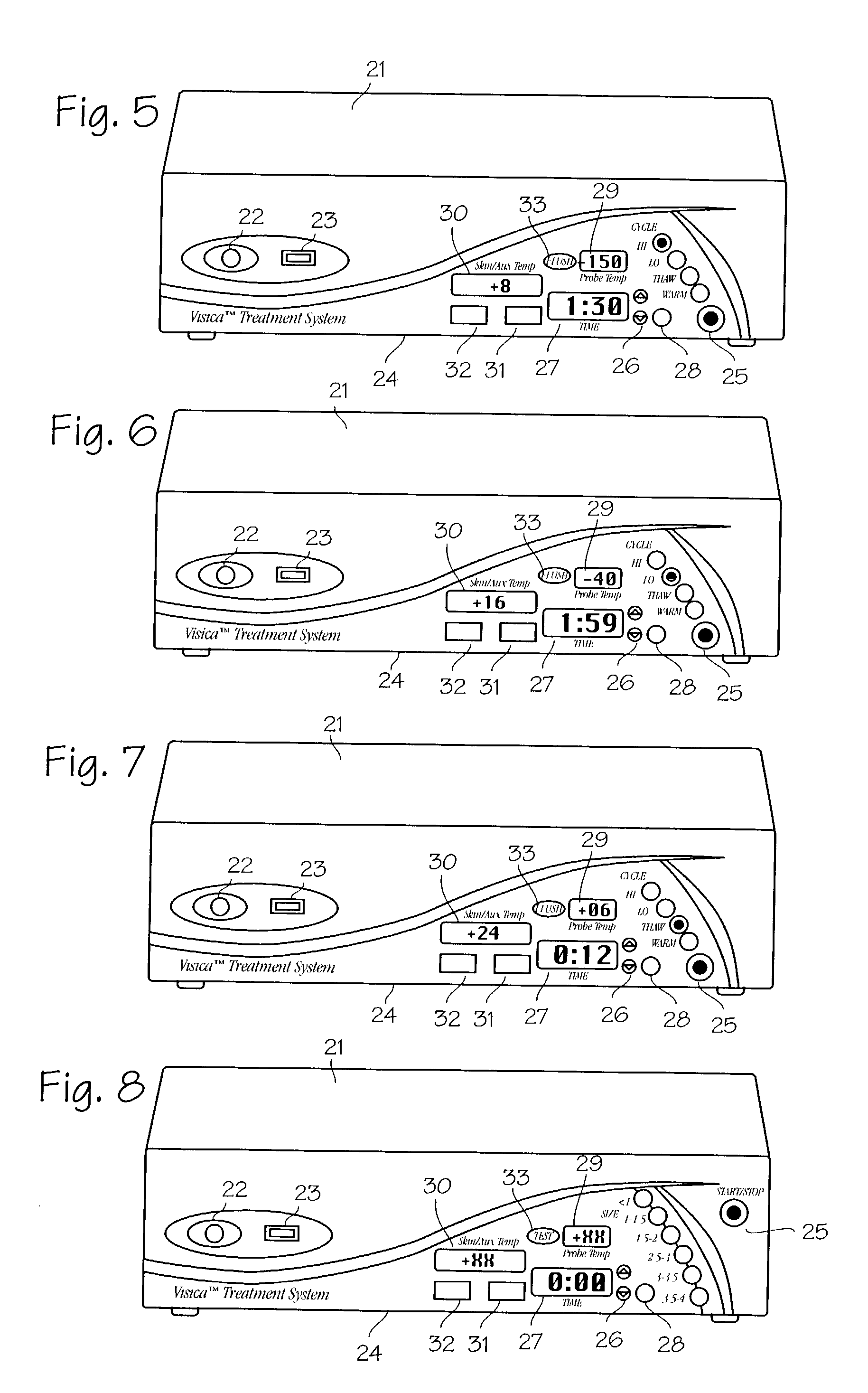 Method and system for cryoablating fibroadenomas