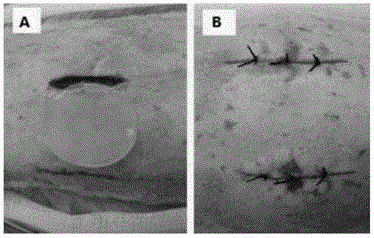 Collagen/silk fibroin composite support and manufacturing method and application thereof