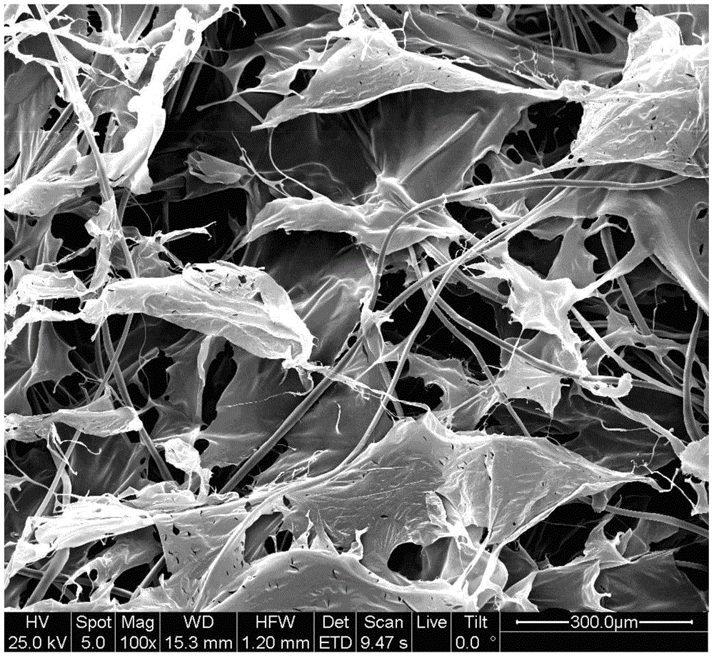 Collagen/silk fibroin composite support and manufacturing method and application thereof