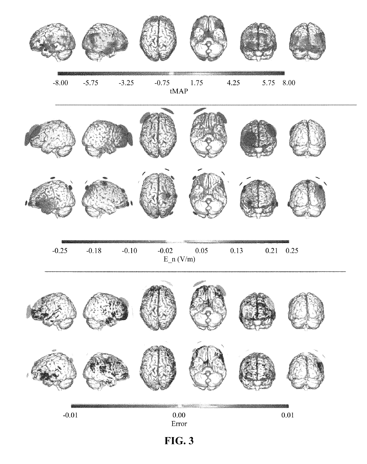 Method and a system for optimizing the configuration of multisite transcranial current stimulation and a computer-readable medium