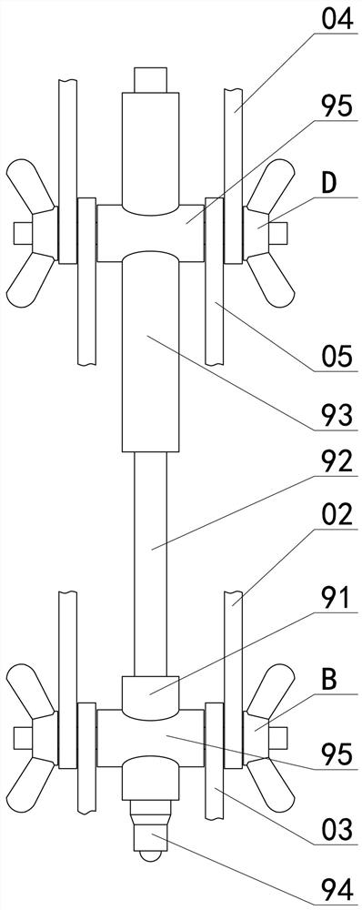 Paracentesis Needle Guide Orientation Device