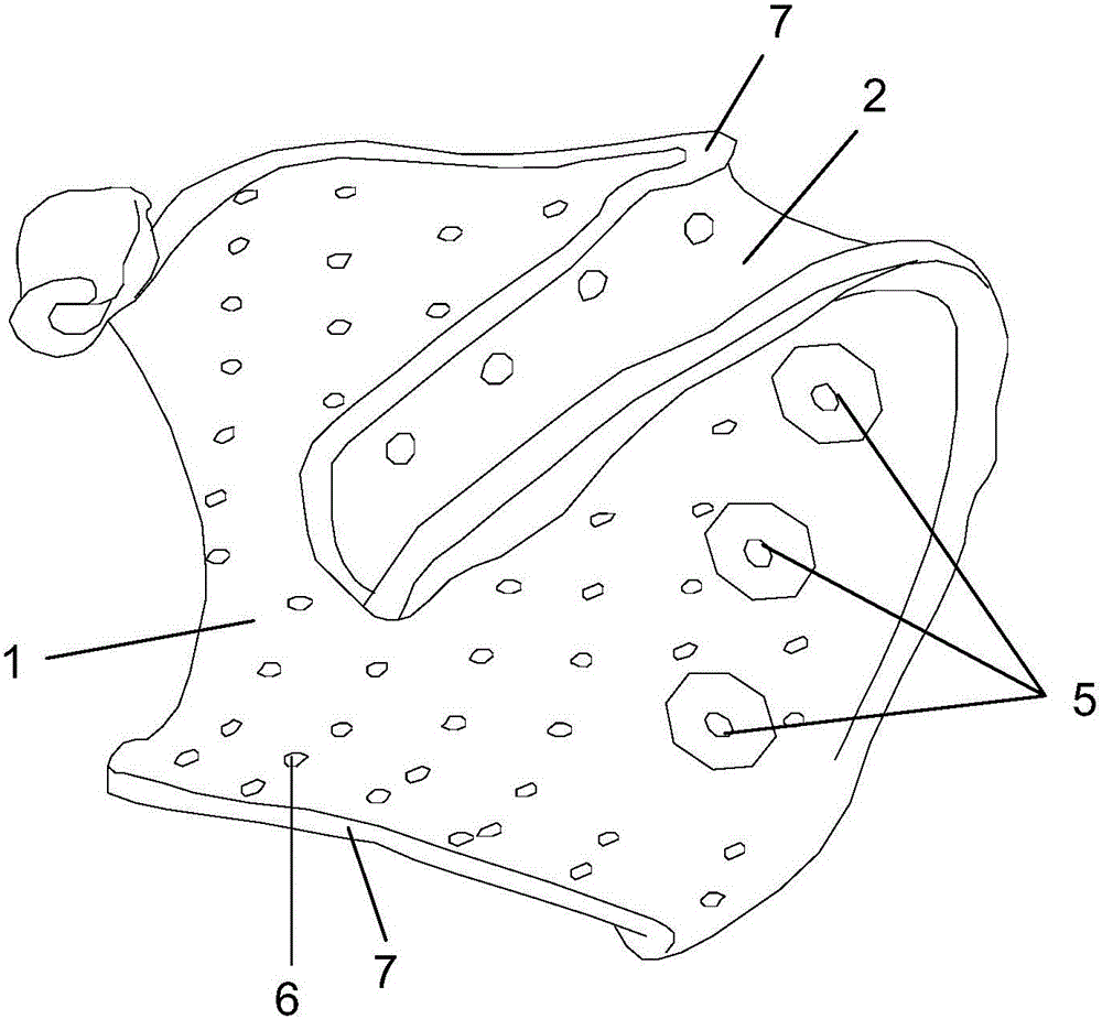 Palm-type rehabilitation brace and rehabilitation method adopting same