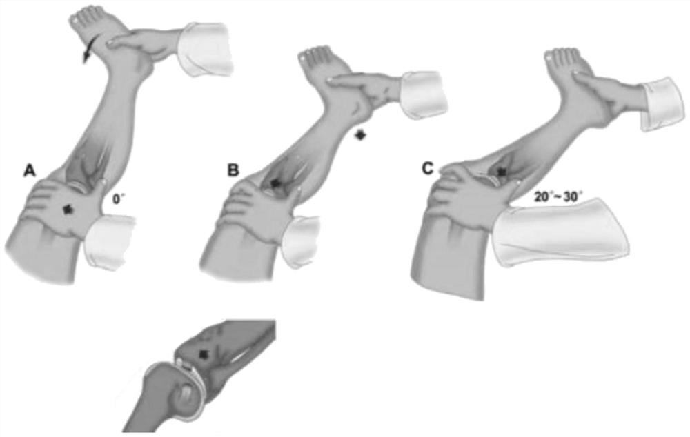 Axial displacement measuring equipment for knee joint cruciate ligament injury