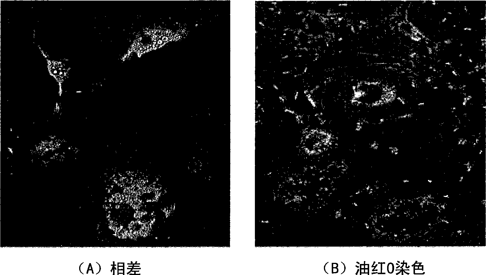 Cosmetic or plastic composition comprising multipotent stem cells derived from human adipose tissue, fibroblast, and adipose or adiopocyte