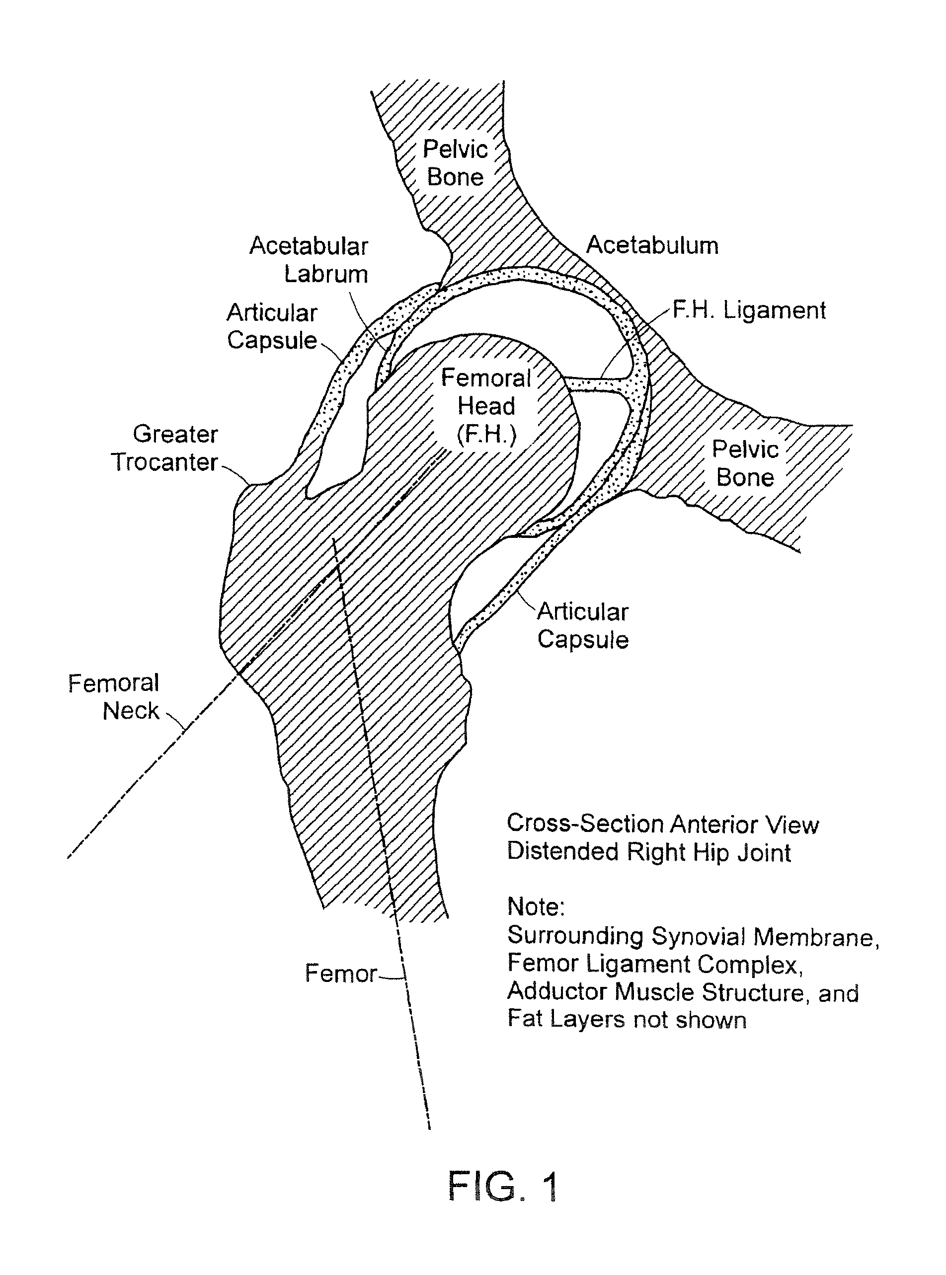 Method and devices for minimally invasive arthroscopic procedures