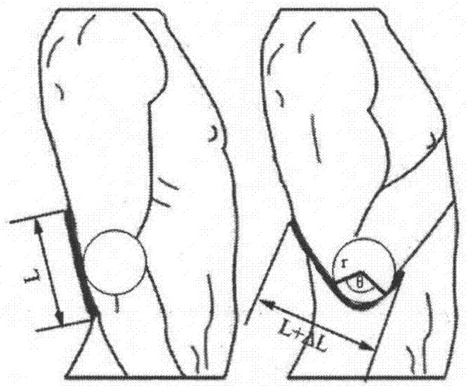 A fabric sensor-based upper limb functional movement monitoring system and method