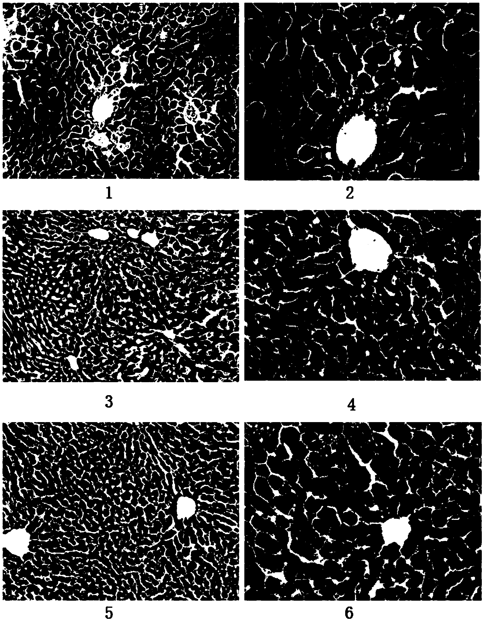 Ring-A polyoxidizing substituted glycyrrhetinic acid derivative and preparation method and application thereof