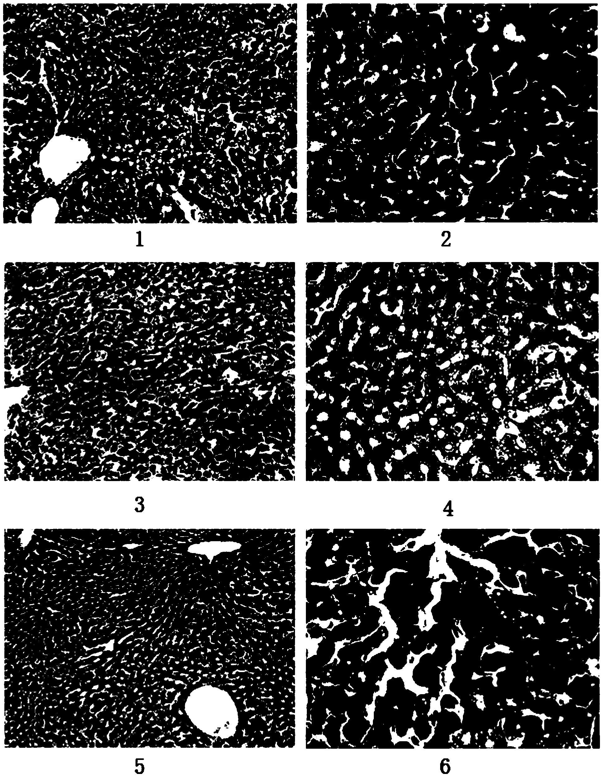 Ring-A polyoxidizing substituted glycyrrhetinic acid derivative and preparation method and application thereof