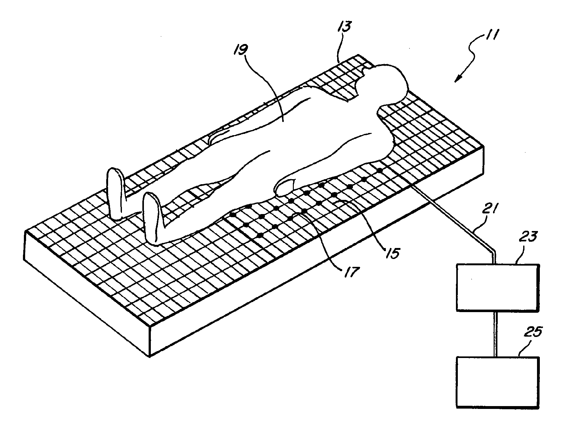 Method And System For Monitoring Pressure Areas On A Supported Body