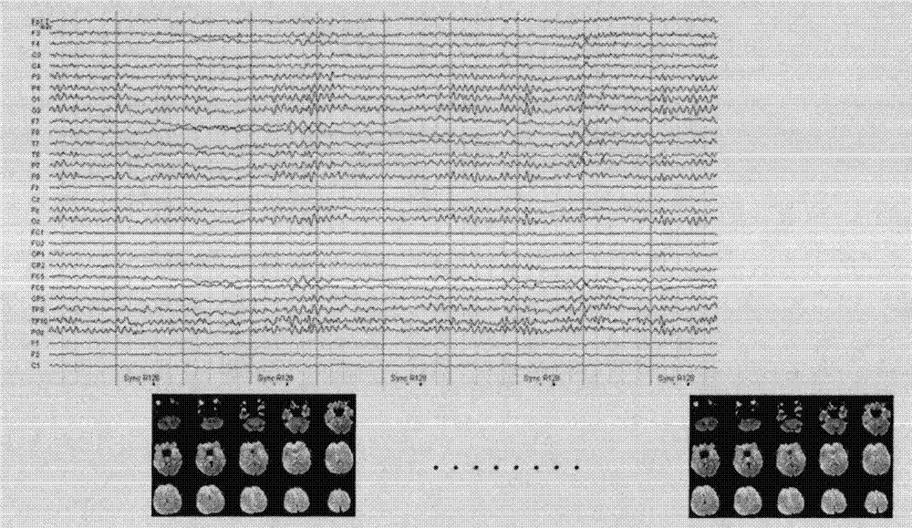 Feedback system combining electroencephalogram and functional magnetic resonance signals